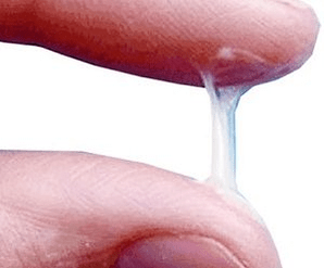 남자의 분비물은 보통 어떤 모습인가요